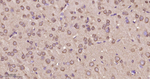 14-3-3 Pan Antibody in Immunohistochemistry (Paraffin) (IHC (P))