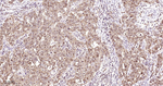 14-3-3 Pan Antibody in Immunohistochemistry (Paraffin) (IHC (P))