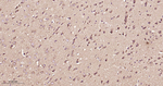 Phospho-mTOR (Ser2448) Antibody in Immunohistochemistry (Paraffin) (IHC (P))