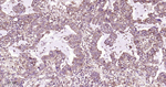 Phospho-mTOR (Ser2448) Recombinant Rabbit Monoclonal Antibody (7F5)
