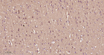 Phospho-mTOR (Ser2448) Antibody in Immunohistochemistry (Paraffin) (IHC (P))