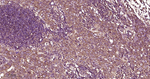 Phospho-mTOR (Ser2448) Antibody in Immunohistochemistry (Paraffin) (IHC (P))