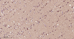 Phospho-mTOR (Ser2448) Antibody in Immunohistochemistry (Paraffin) (IHC (P))