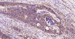Phospho-mTOR (Ser2448) Antibody in Immunohistochemistry (Paraffin) (IHC (P))
