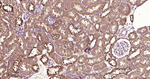Phospho-mTOR (Ser2448) Antibody in Immunohistochemistry (Paraffin) (IHC (P))