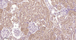 Phospho-mTOR (Ser2448) Antibody in Immunohistochemistry (Paraffin) (IHC (P))