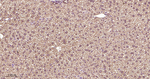 Phospho-mTOR (Ser2448) Antibody in Immunohistochemistry (Paraffin) (IHC (P))