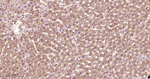 Phospho-mTOR (Ser2448) Antibody in Immunohistochemistry (Paraffin) (IHC (P))