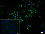 4EBP1 Recombinant Rabbit Monoclonal Antibody (9F8)