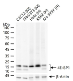 4EBP1 Antibody in Western Blot (WB)