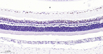 MiTF Antibody in Immunohistochemistry (Paraffin) (IHC (P))