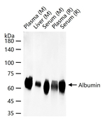 Albumin Antibody in Western Blot (WB)