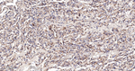 IFITM3 Antibody in Immunohistochemistry (Paraffin) (IHC (P))