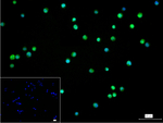 BCL11A Recombinant Rabbit Monoclonal Antibody (4H12)