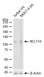 BCL11A Antibody in Western Blot (WB)