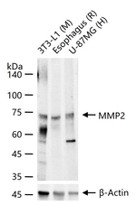 MMP2 Recombinant Rabbit Monoclonal Antibody (9F5)