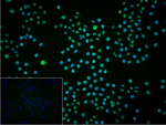 MATR3 Recombinant Rabbit Monoclonal Antibody (5F9)