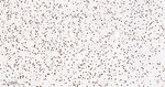 MATR3 Antibody in Immunohistochemistry (Paraffin) (IHC (P))