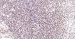 MATR3 Antibody in Immunohistochemistry (Paraffin) (IHC (P))