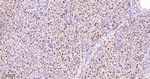 MATR3 Antibody in Immunohistochemistry (Paraffin) (IHC (P))
