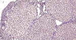 MATR3 Antibody in Immunohistochemistry (Paraffin) (IHC (P))