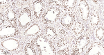 MATR3 Antibody in Immunohistochemistry (Paraffin) (IHC (P))