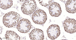 MATR3 Antibody in Immunohistochemistry (Paraffin) (IHC (P))