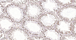 MATR3 Antibody in Immunohistochemistry (Paraffin) (IHC (P))