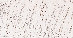 MATR3 Antibody in Immunohistochemistry (Paraffin) (IHC (P))