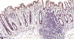 MATR3 Antibody in Immunohistochemistry (Paraffin) (IHC (P))