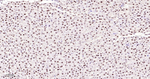 MATR3 Antibody in Immunohistochemistry (Paraffin) (IHC (P))