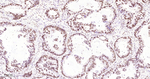 MATR3 Antibody in Immunohistochemistry (Paraffin) (IHC (P))