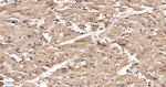 PFKM Antibody in Immunohistochemistry (Paraffin) (IHC (P))