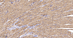 PFKM Antibody in Immunohistochemistry (Paraffin) (IHC (P))