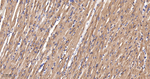 PFKM Antibody in Immunohistochemistry (Paraffin) (IHC (P))