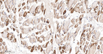 PFKM Antibody in Immunohistochemistry (Paraffin) (IHC (P))
