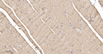 PFKM Recombinant Rabbit Monoclonal Antibody (2F5)