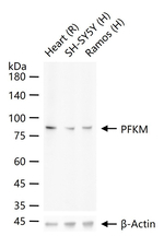 PFKM Antibody in Western Blot (WB)