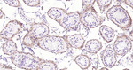 Versican Antibody in Immunohistochemistry (Paraffin) (IHC (P))