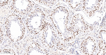 OCT1 Antibody in Immunohistochemistry (Paraffin) (IHC (P))