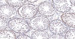 OCT1 Antibody in Immunohistochemistry (Paraffin) (IHC (P))