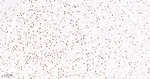 OCT1 Antibody in Immunohistochemistry (Paraffin) (IHC (P))