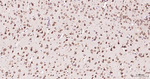 eIF4E Antibody in Immunohistochemistry (Paraffin) (IHC (P))