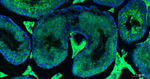 eIF4E Antibody in Immunohistochemistry (Paraffin) (IHC (P))