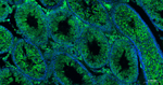 eIF4E Antibody in Immunohistochemistry (Paraffin) (IHC (P))