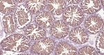 eIF4E Antibody in Immunohistochemistry (Paraffin) (IHC (P))