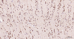 eIF4E Antibody in Immunohistochemistry (Paraffin) (IHC (P))