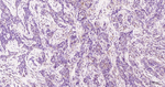 eIF4E Antibody in Immunohistochemistry (Paraffin) (IHC (P))
