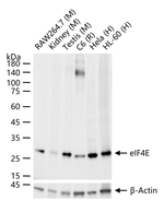 eIF4E Antibody in Western Blot (WB)