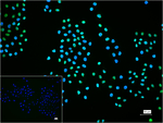 MCM2 Recombinant Rabbit Monoclonal Antibody (7F5)